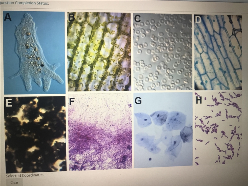 Which of the following is a prokaryote? Will award 25 points-example-1