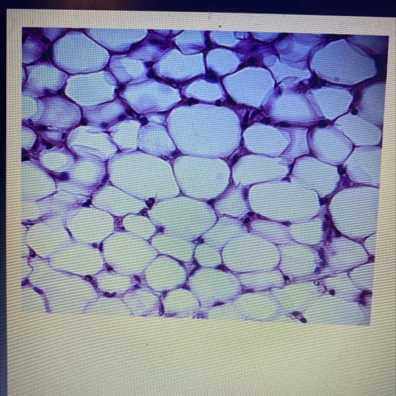 Which level of organization is shown in the image? cell tissue organ organ system-example-1