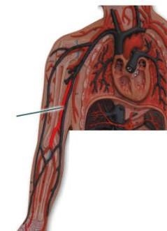 What are the terminal branches of the highlighted artery? What are the terminal branches-example-1