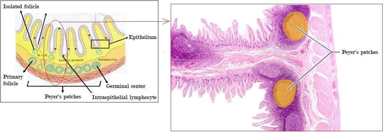 Which structures are highlighted? Which structures are highlighted? duodenal glands-example-1