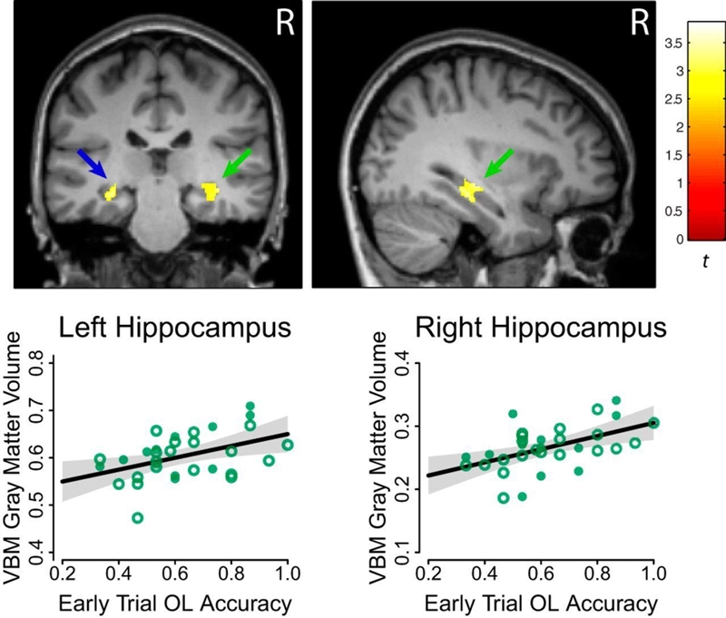 Damage to the ________ is most likely to interfere with explicit memories of newly-example-1