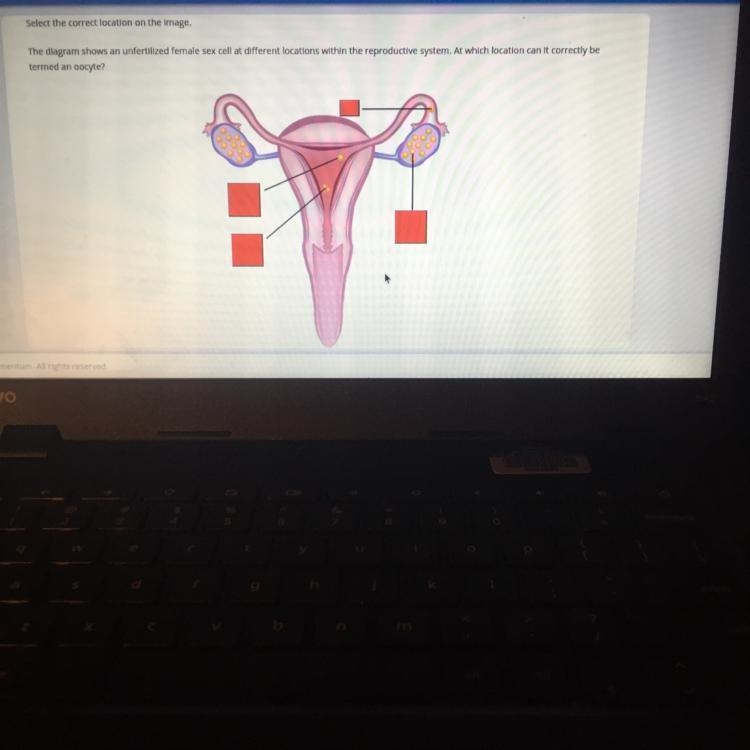 Select the correct location on the image. The diagram shows an unfertilized female-example-1