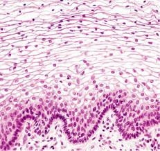 Correctly identify this tissue type and then label the features of the tissue.-example-1