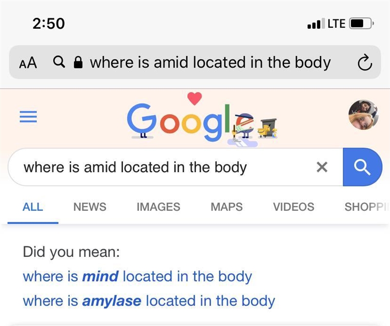 Where is amid located in the body-example-1