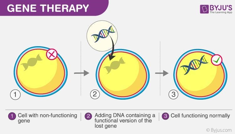 Why are polygenic diseases less suited to gene therapy?-example-1