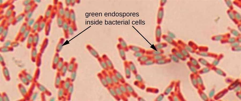 When a cell containing an endospore (such as Bacillus subtilis) is stained with the-example-1