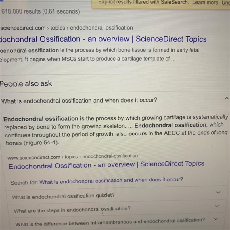 What is Endochondral Ossification?-example-1