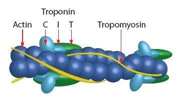 Which of the following answers describes the most direct consequence of tropomyosin-example-1