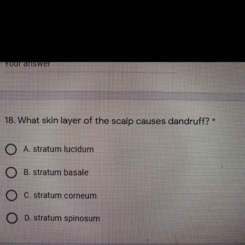 What skin layer of the scalp causes dandruff?-example-1