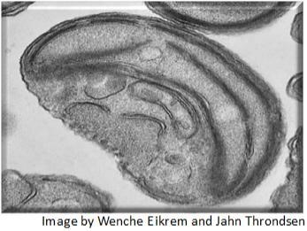 What is the entire object shown in the image? A. prokaryote B. eukaryote C. chloroplast-example-1