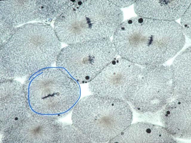 Will get 60 POINTS! What stage of mitosis is indicated in the picture below: (Whitefish-example-1