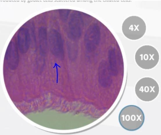 The cell structure at the arrow in the picture below is present in these cells which-example-1