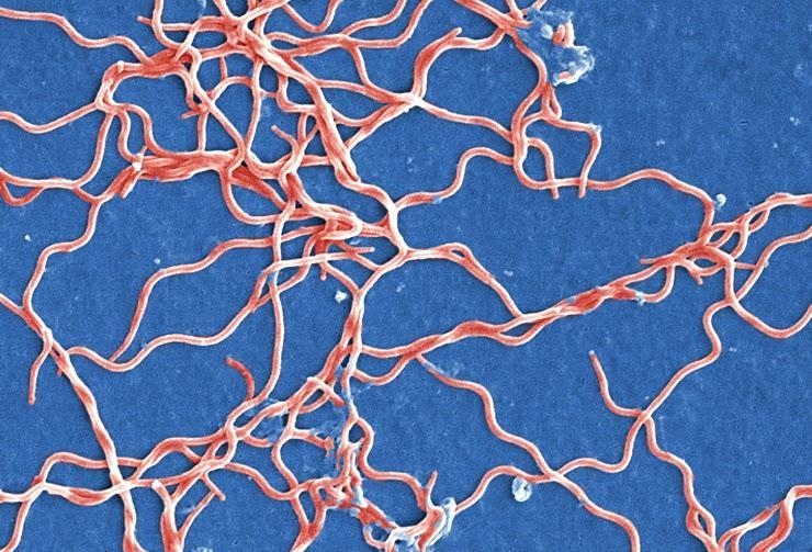 The bacteria in the picture below falls into which category? Staphylo Spirilla Bacillus-example-1