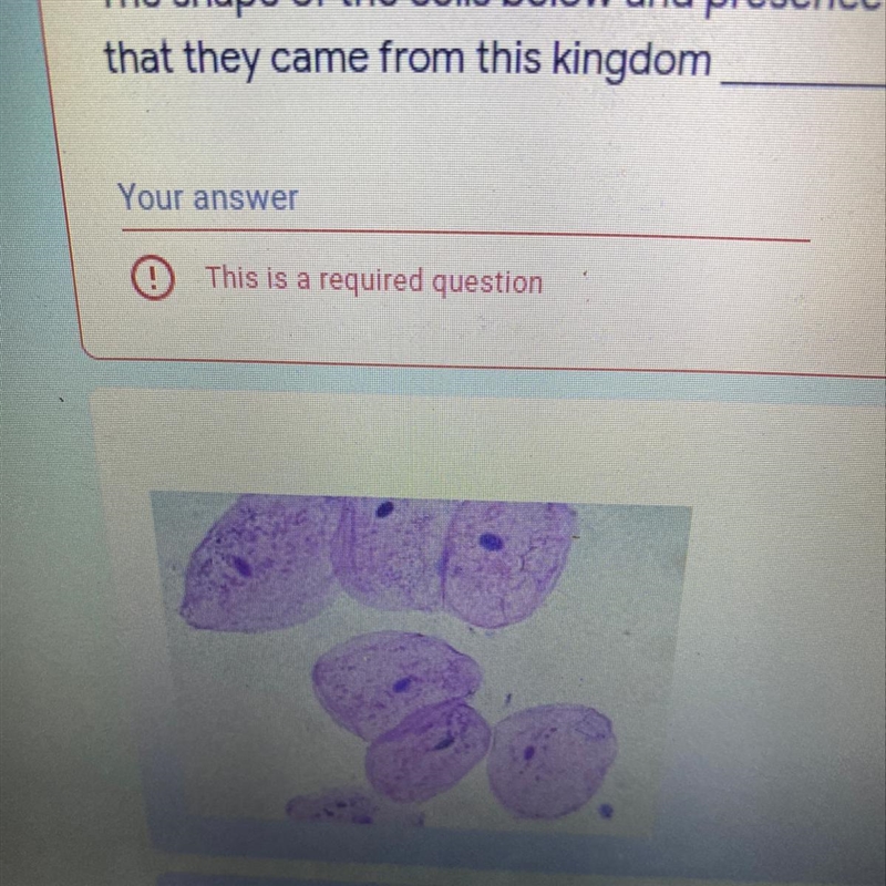 The shape of the cells below and presence of the nucleus in the center indicates that-example-1