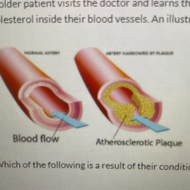 Increase blood pressure Increase blood volume Decrease blood volume-example-1