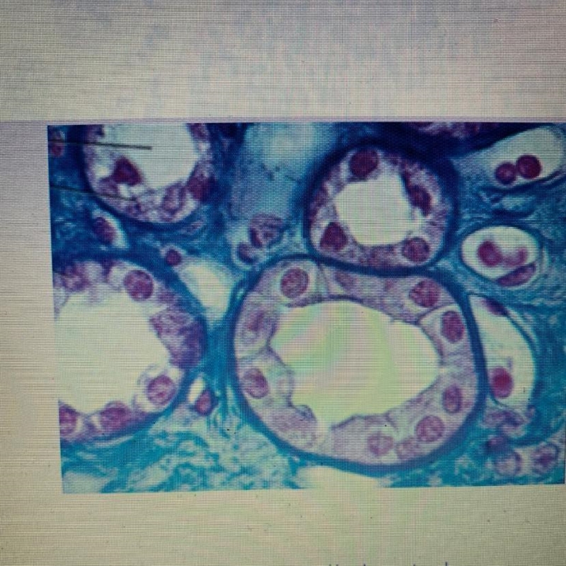 This tissue type consists of single-layer of box-shaped cells that have a centrally-example-1