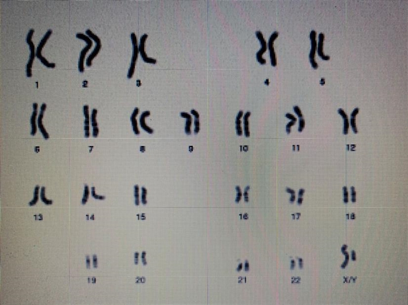 Take a look at the image of a karyotype below. What can you tell from this karyotype-example-1