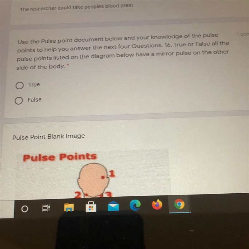 All the pulse points have a mirror pulse on the other side of the body. True or false-example-1