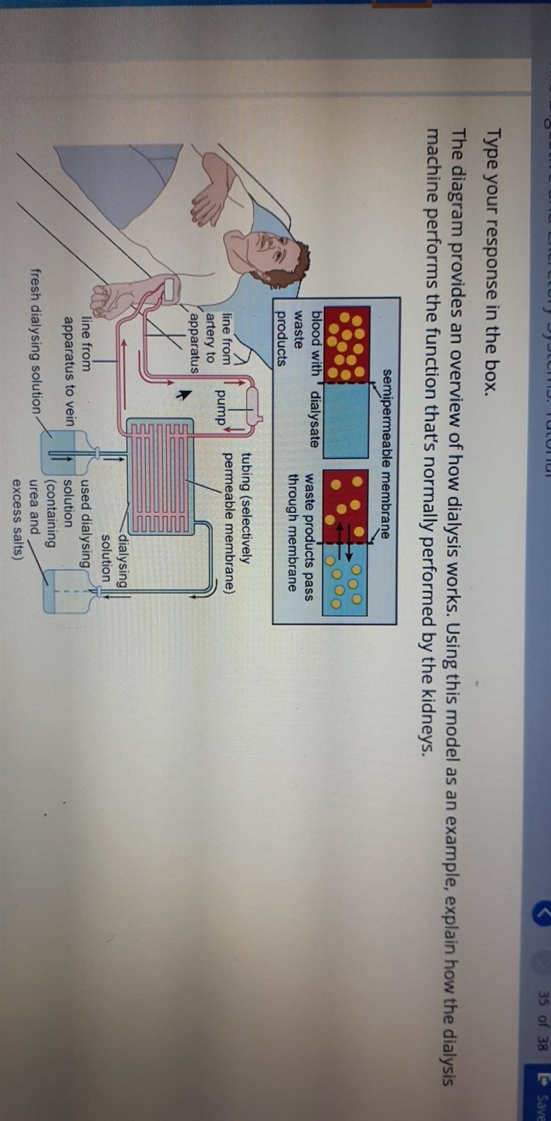 The diagram provides an overview of how dialysis works. Using this model as an example-example-1