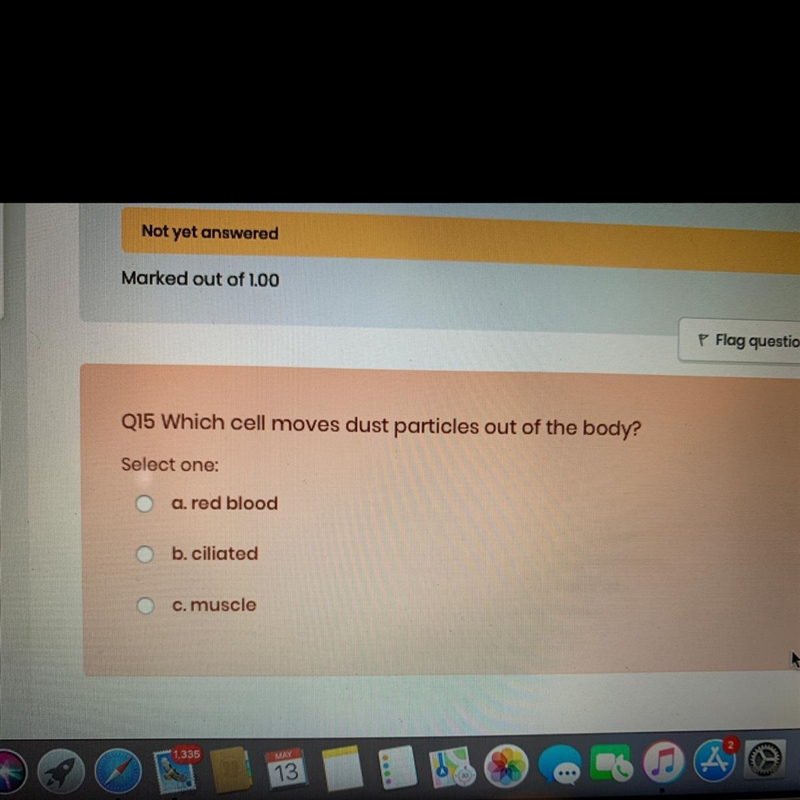 Which cell moves dust out of the body-example-1