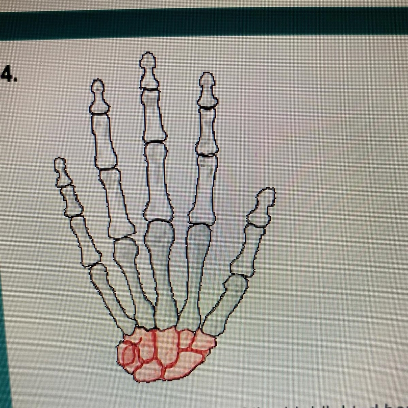 What is the name of the highlighted bone? Carpal Tarsal Phalanges Meta-Carpal someone-example-1