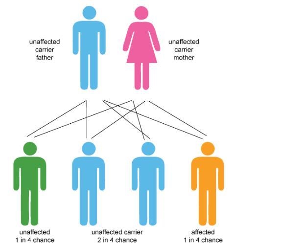 PLEASE HELP!! 30 POINTS. Galactosemia is an inherited genetic condition. Children-example-1