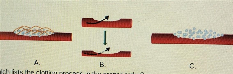 The diagram shows three steps in the clotting process. Which lists the clotting process-example-1