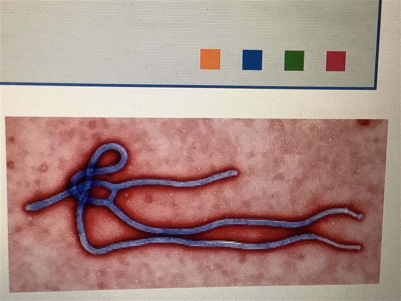 What kind of virus is this a phot of?-example-1