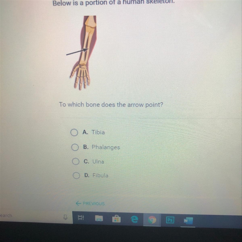 To which bone does the arrow point? O A. Tibia O B. Phalanges O C. Ulna OD. Fibula-example-1