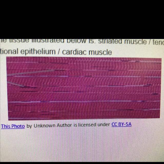 The tissue the picture above is: A. Striated muscle B. Tendon C. Smooth muscle D. Transitional-example-1