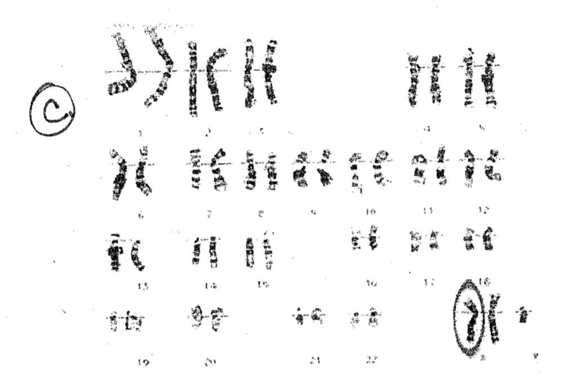 Figure C represents what disorder?-example-1