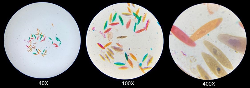 Describe how Stella’s view of these cells and their parts changed as she transitioned-example-1