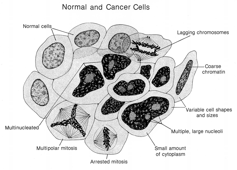 HELP EASY 5TH GRADER WORK I am having difficulties finding a cancer cell model that-example-1