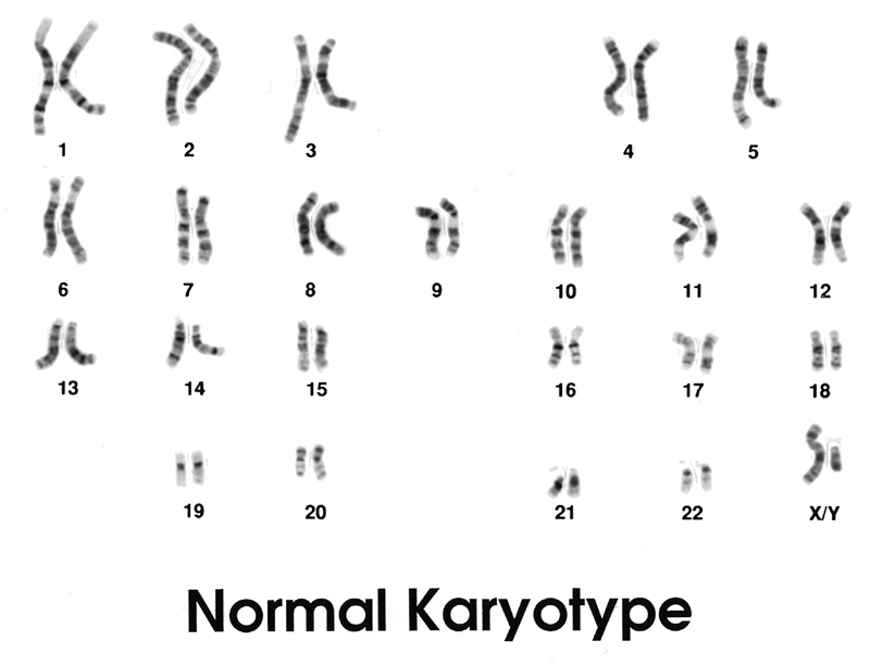 A micrograph of matched pairs of human chromosomes can be used to confirm the overall-example-1