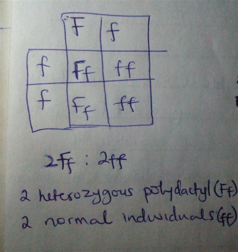 In humans, polydactyly (an extra finger on each hand or toe on each foot) is due to-example-1