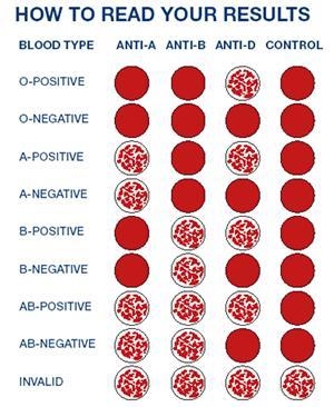 What is the difference between the one with a bunch of red dots (Anti Rh, Anti B) and-example-1