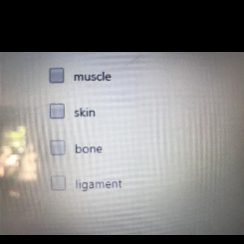 Tendons are supportive structures that attach a_____ to a _____( choose all that apply-example-1