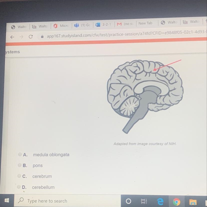 Dentify the part of the brain indicated by the red arrow-example-1