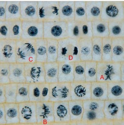 Which labeled cell (A,B,C,D) represents a cell in anaphase? How did you know?-example-1