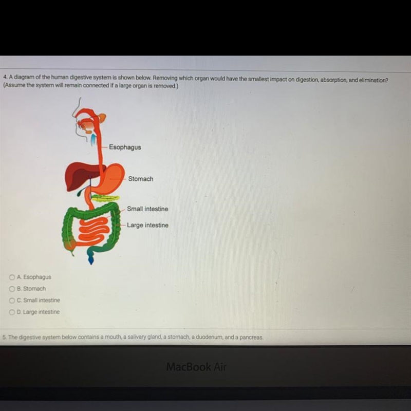 4. A diagram of the human digestive system is shown below. Removing which organ would-example-1