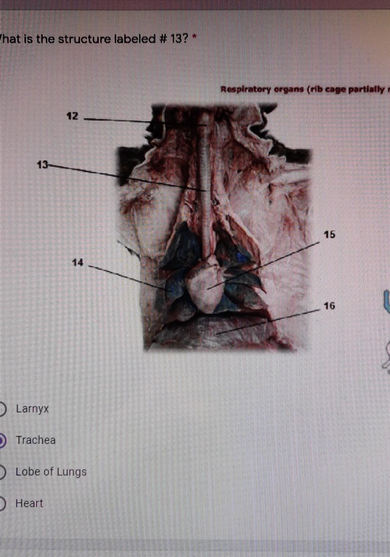 What is the structure labeled # 13? * 1 point Respiratory organs (rib cage partially-example-1