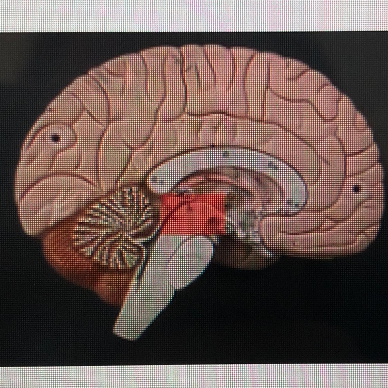 What is the red highlighted part? A.midbrain B.cerebellum C. pons D.medulla oblongata-example-1