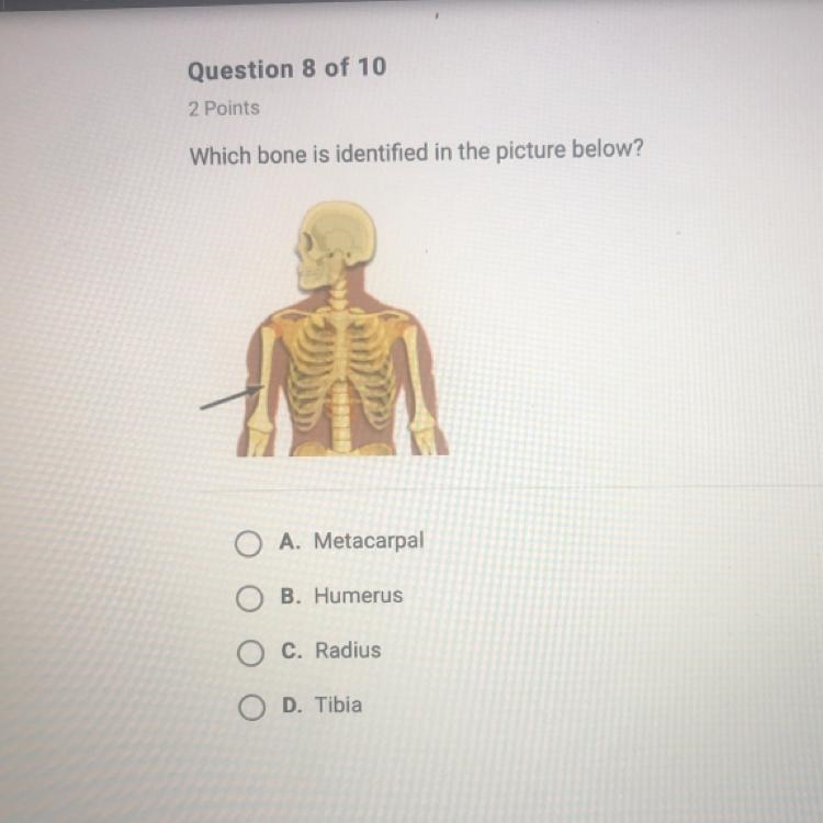 Which bone is identified in the picture below?-example-1