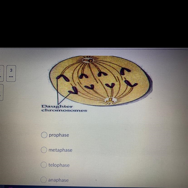 What phase of the cell cycle is happening in this picture? A)Prophase B)Metaphase-example-1