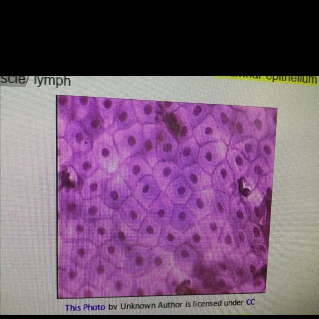 The tissue illustrated above is: A. Squamous epithelium B. Columnar epithelium C. Nervous-example-1