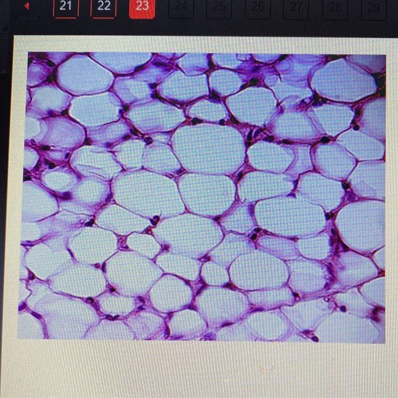 Which level of organization is shown in the image? -cell -tissue -organ -organ system-example-1