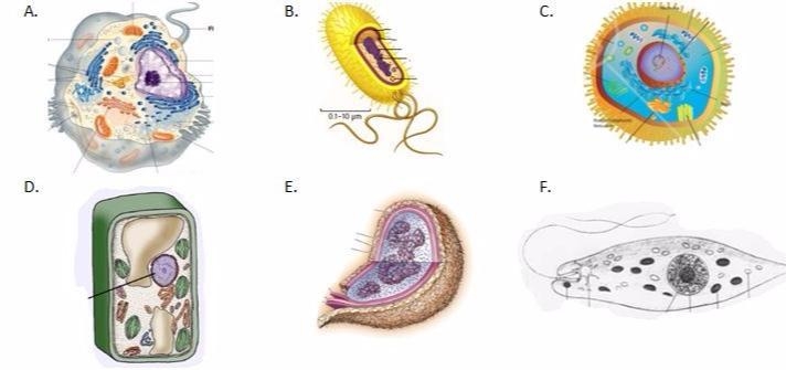 Which of the following images are prokaryotic cells? Justify your choice(s). Which-example-1