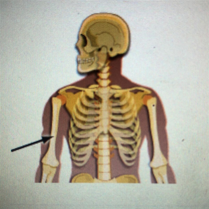 Which bone is identified in the picture below? O A. Metacarpal O B. Radius Ос. тibia-example-1