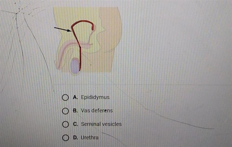 Help plz!!!!!!what part of the reproductive system is highlighted below​-example-1