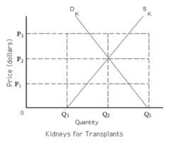 Refer to exhibit 4-5. if a free market were allowed in the transplanted kidney market-example-1